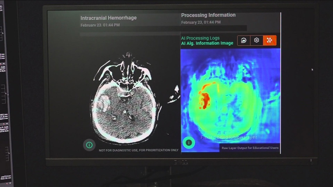Mercy Hospitals & AI: Enhancing Health Outcomes - News Directory 3
