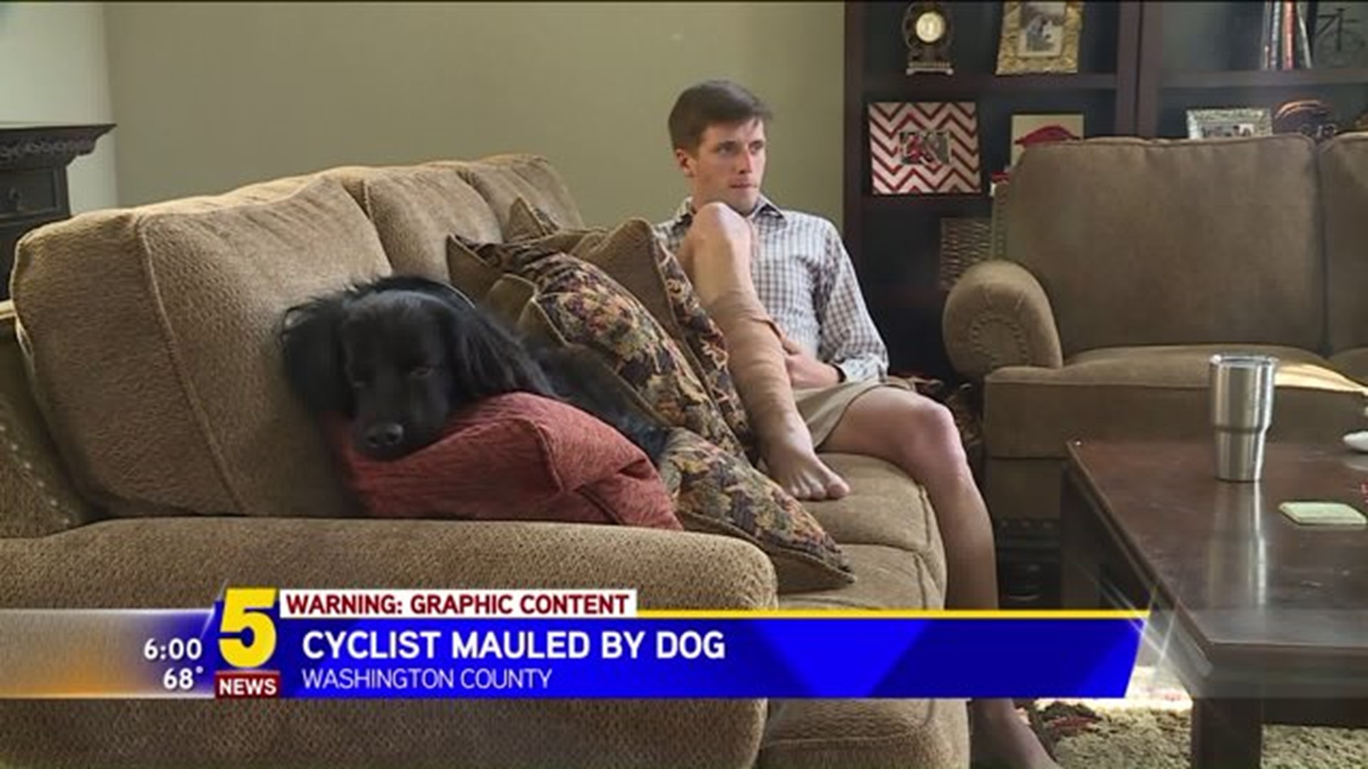 Cyclist Mauled By Dog Speaks Out