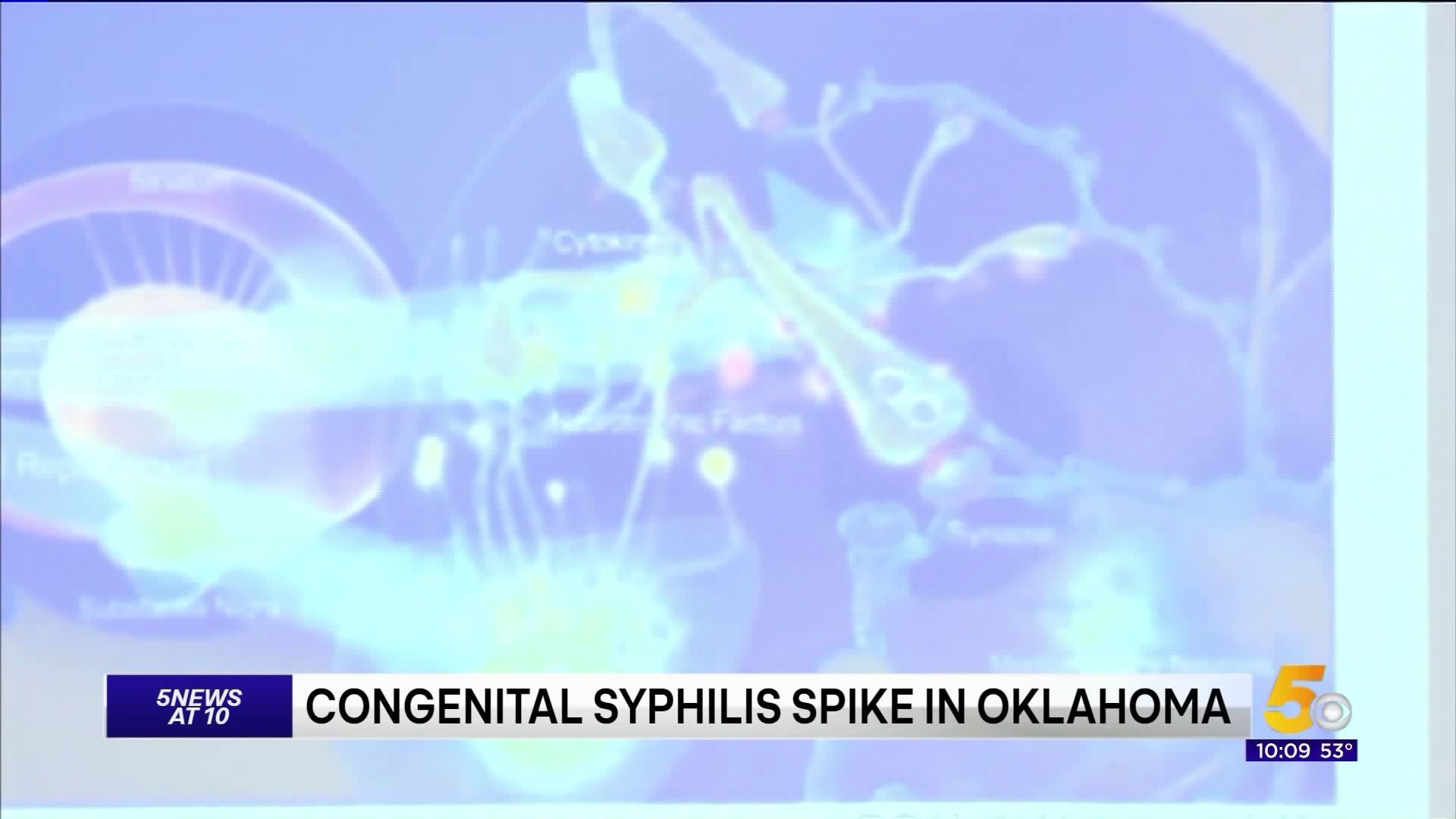 Cases Of Congenital Syphilis Increasing In Oklahoma