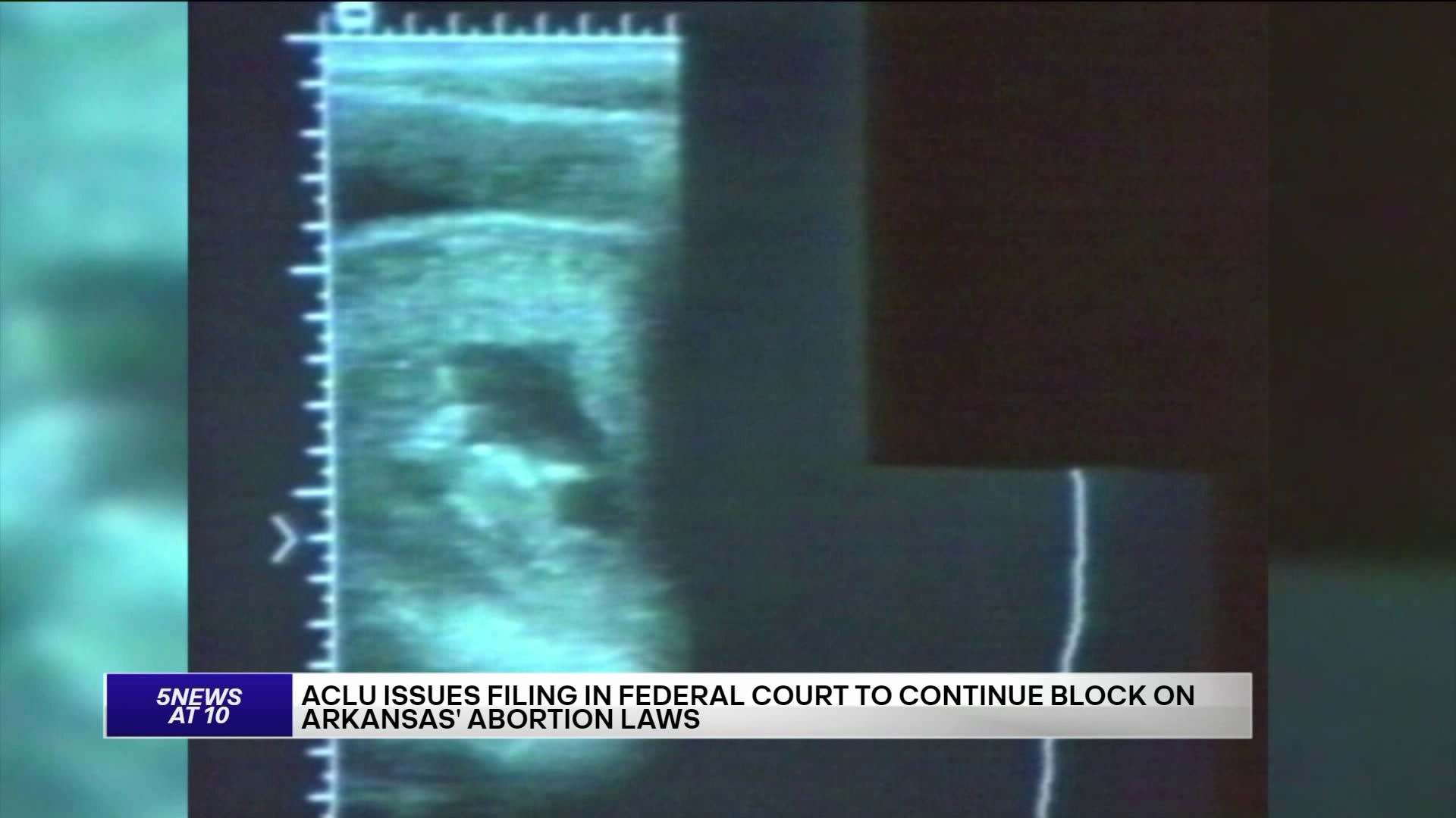 Briefs Filed To Continue Block On Arkansas Abortion Laws