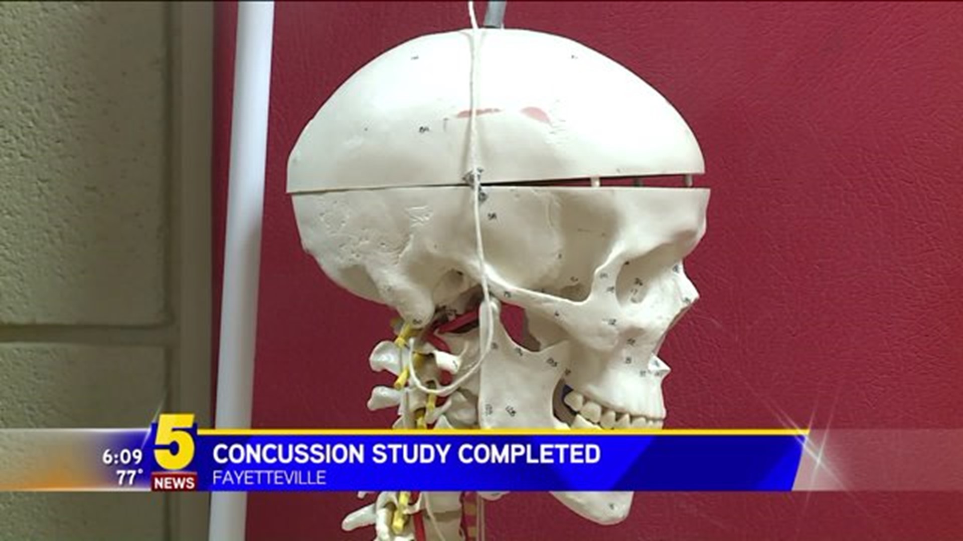Concussion Story
