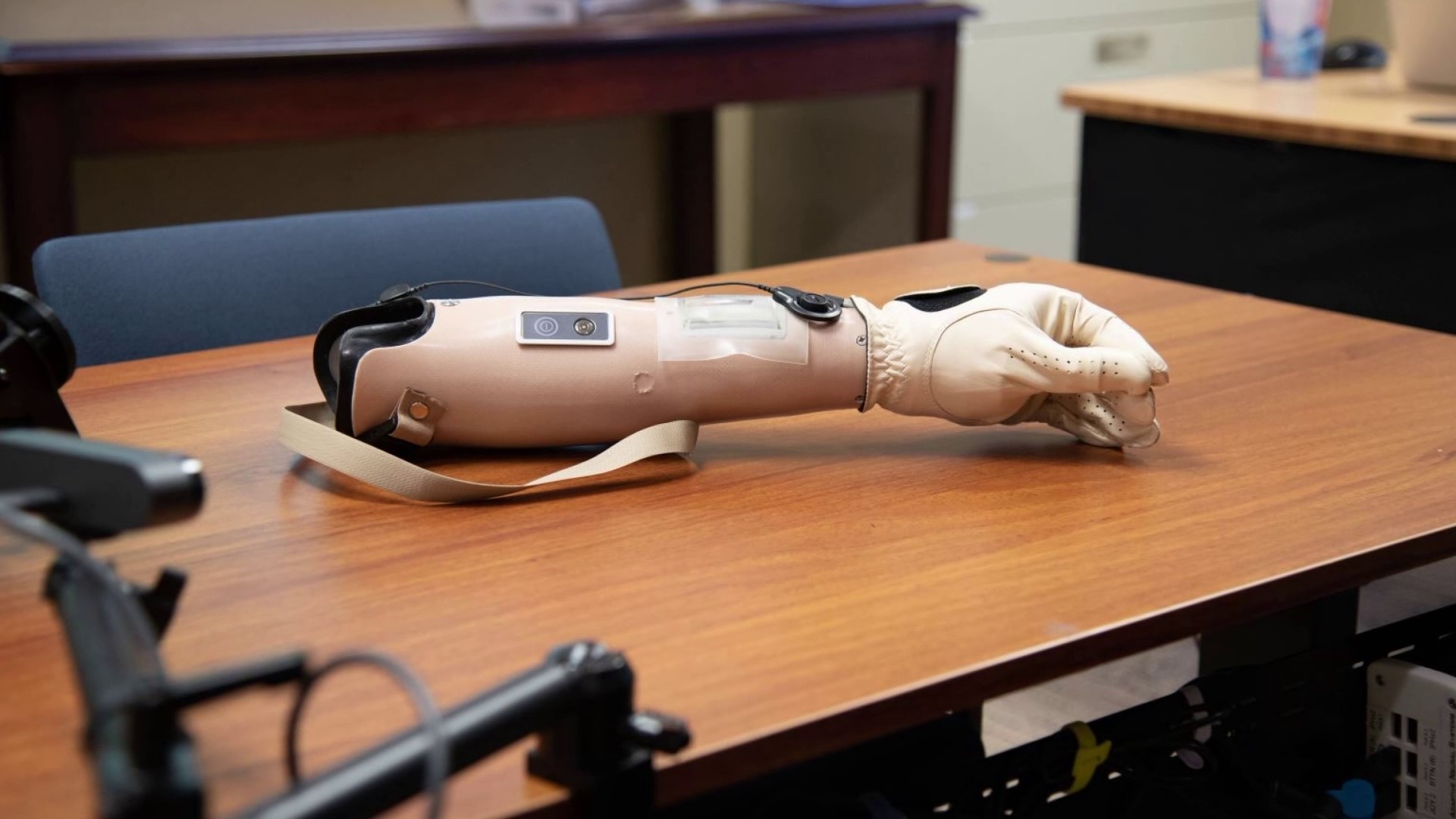 U of A granted $4.9 million for prosthesis research