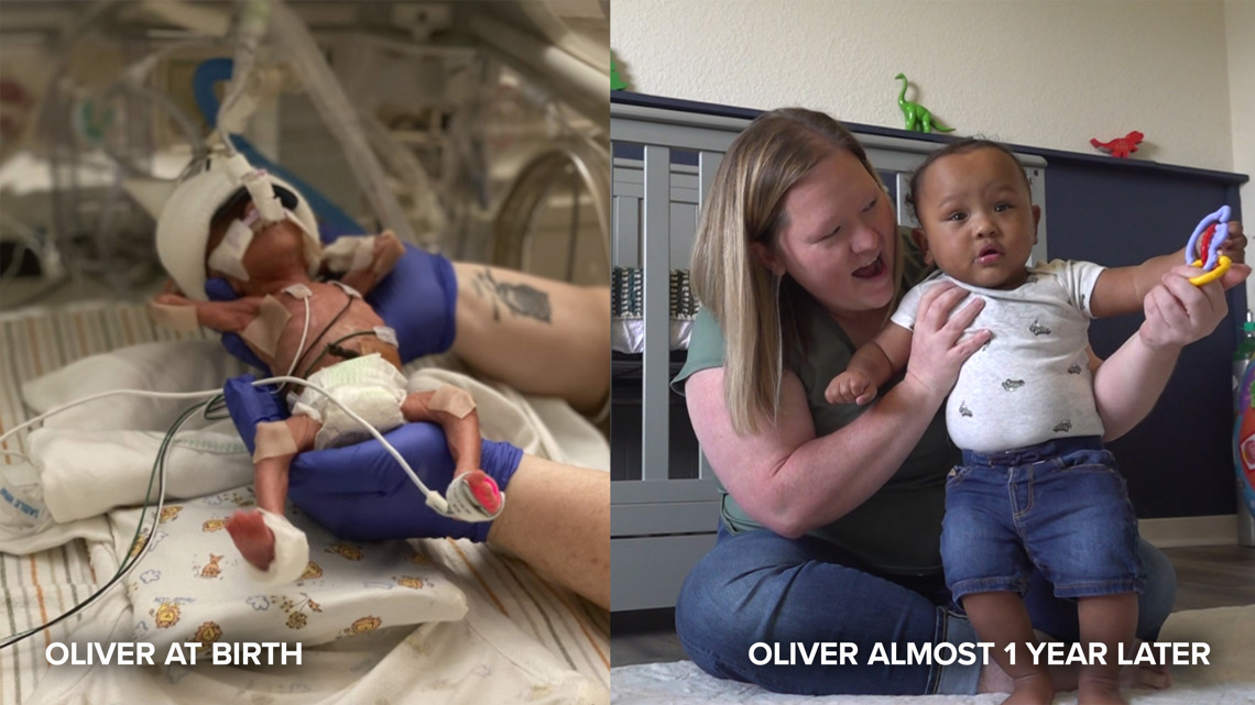 Arkansas mother recounts giving birth at 23 weeks