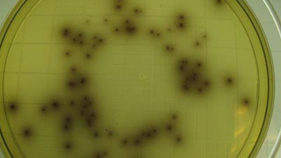 Listeria In Caramel Apples Kills At Least 4; Cases In 10 States