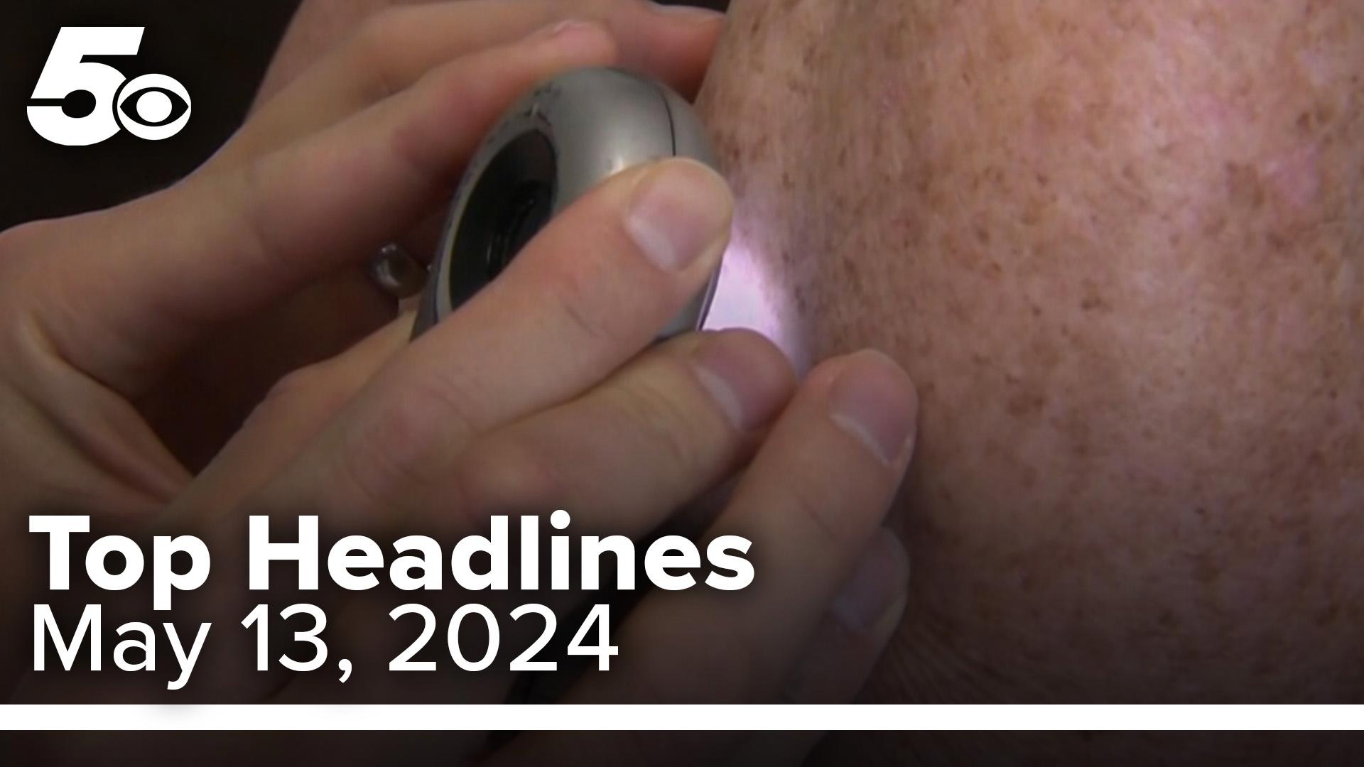 A Fort Smith dermatologist talks about ways to spot melanoma. Learn about this and more on your 5NEWS Top Headlines.