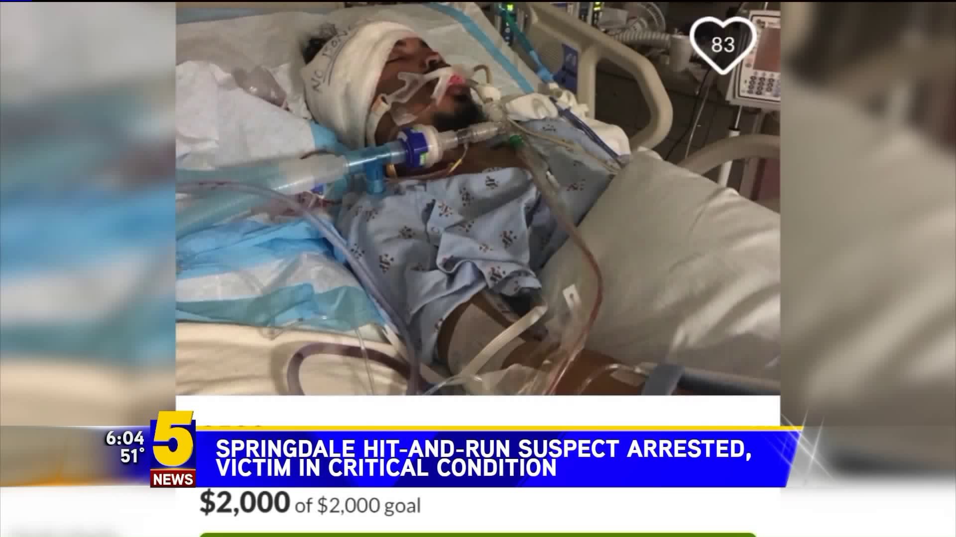 Springdale Hit-And-Run Suspect Arrested, Victim In Critical Condition