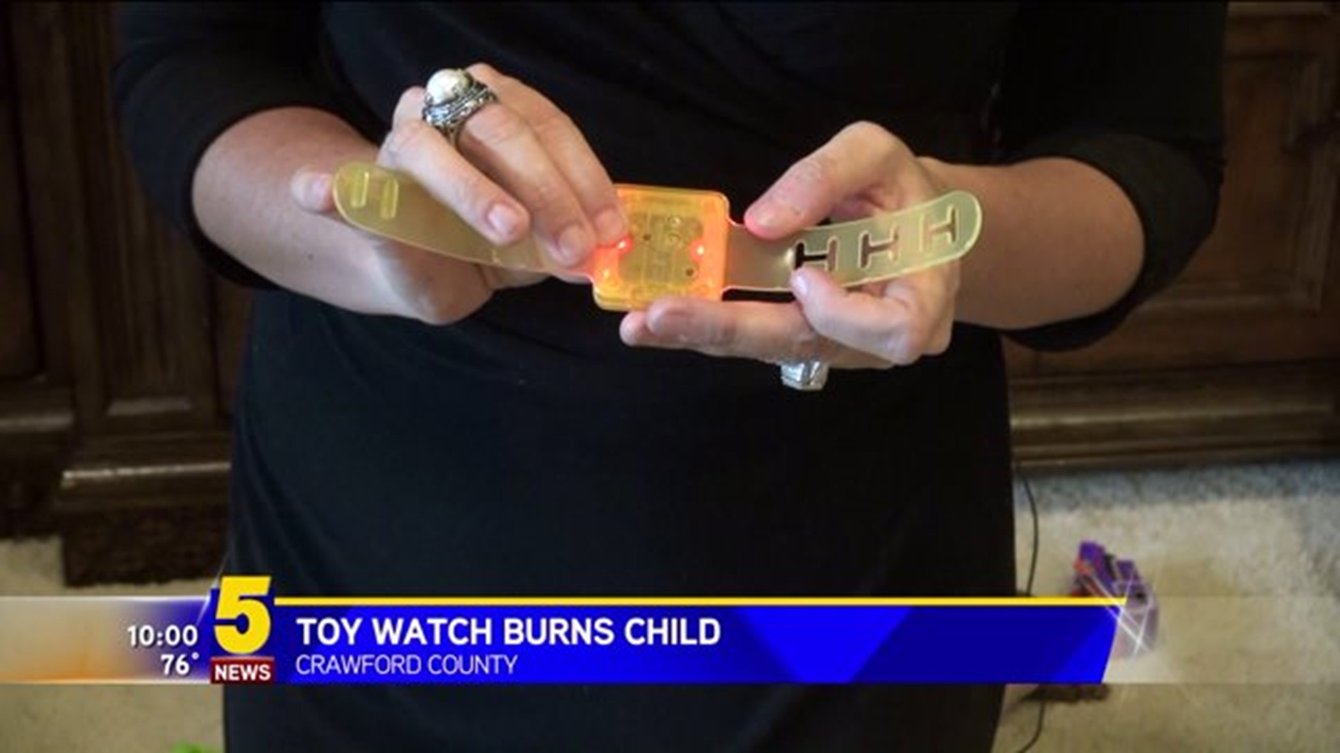 Toy Watch Burns Child
