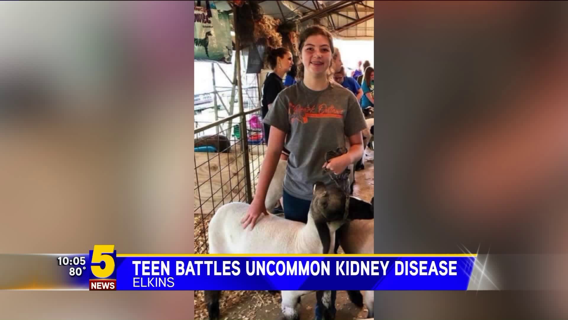 Elkins Teen Battles Kidney Disease
