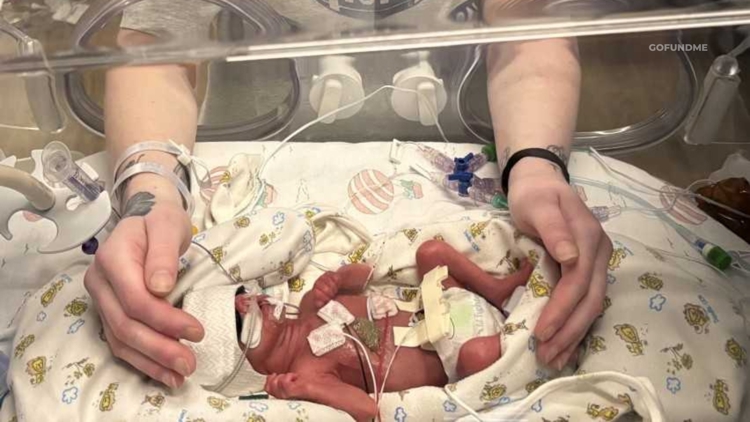 Christmas miracle: Oregon couple delivers premature twin in car during North Dakota ice storm