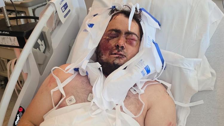 Man critically injured after boulder pins him at Astoria marina jetty