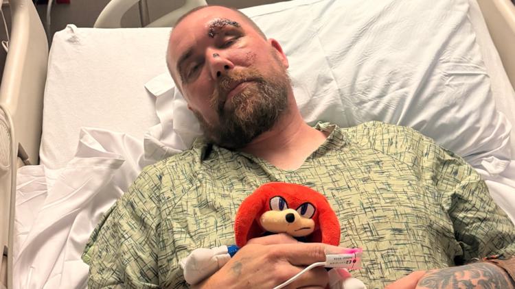 Salem hit-and-run leaves chef hospitalized with serious injuries