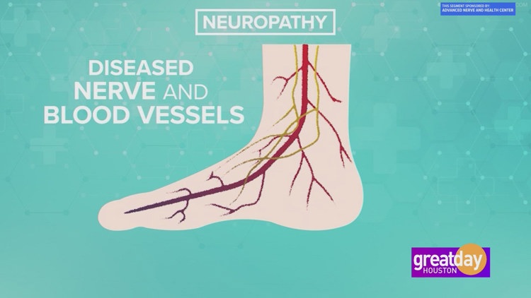 Sponsored: Relieve Your Neuropathy With Advanced Nerve And Health Center