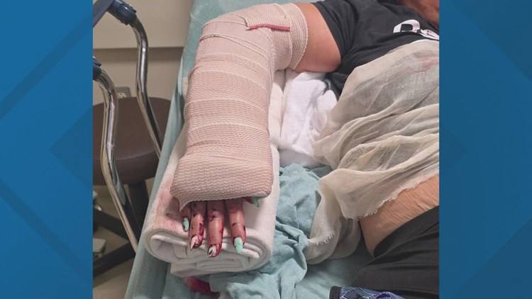 'I could have been killed' | Nanny says stranger attacked her with baseball bat while walking baby in Sugar Land