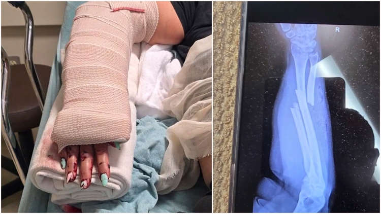 'I could have been killed' | Nanny says stranger attacked her with baseball bat while walking baby in Sugar Land