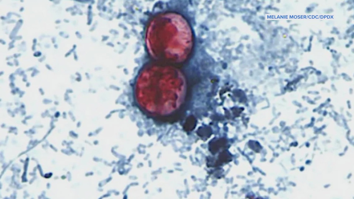 Cyclospora cases rise, water park safety tips and what's really behind low testosterone