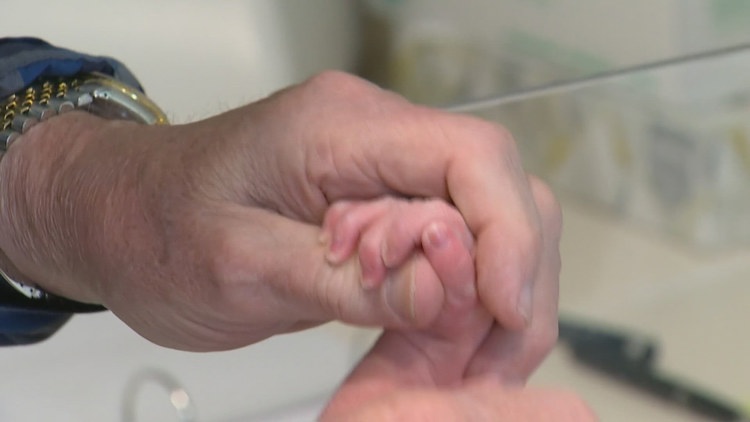 FDA links recalled baby formula to three botulism cases, including one in Washington