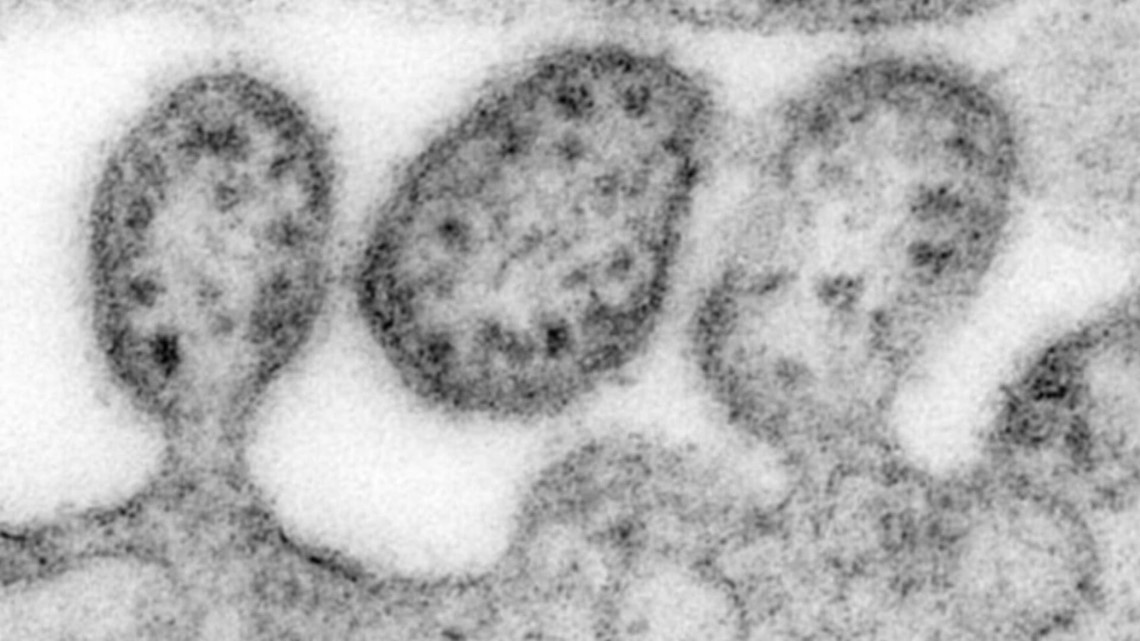 your-questions-about-lassa-fever-answered-weareiowa