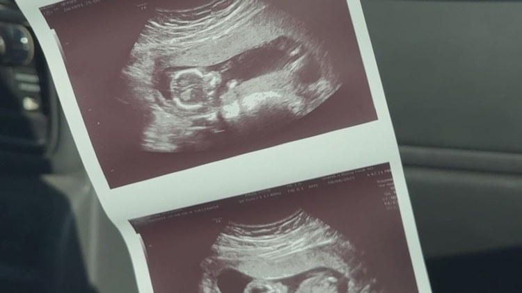 Pregnant mom fighting through rare, aggressive cancer, focused on welcoming baby girl