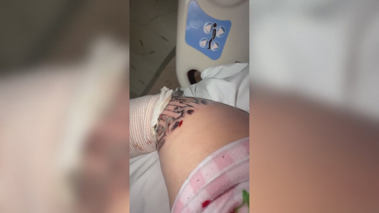 Arizona woman's tattoo lands her in hospital with severe complications