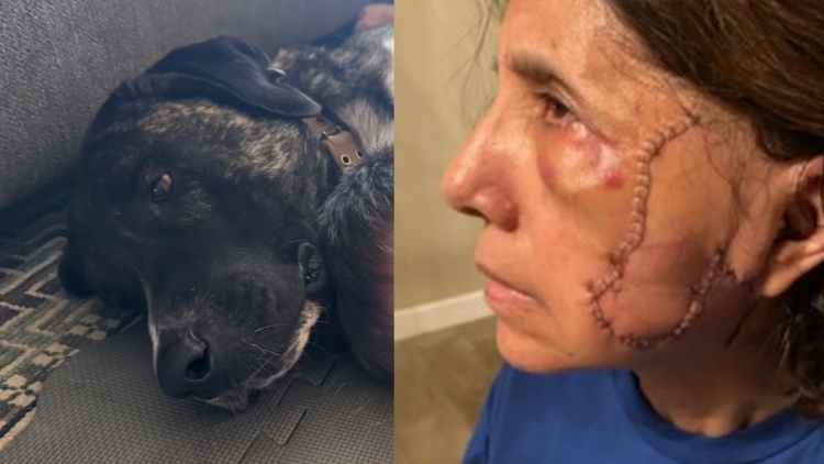 Saving Sgt. Snuggles: Tucson dog owner fights to save the dog that attacked her mother