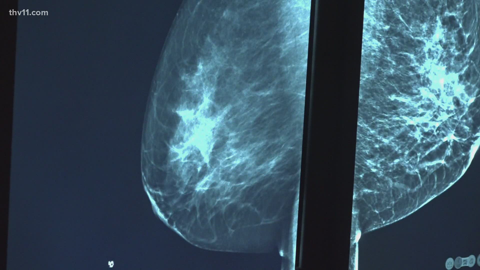 THV11's Craig O'Neill explains why breast cancer screenings shouldn't stop because of COVID-19.
