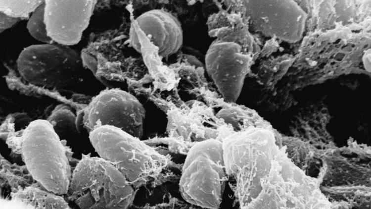 Person in southern Colorado tests positive for plague