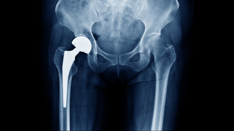 It's all in the hips