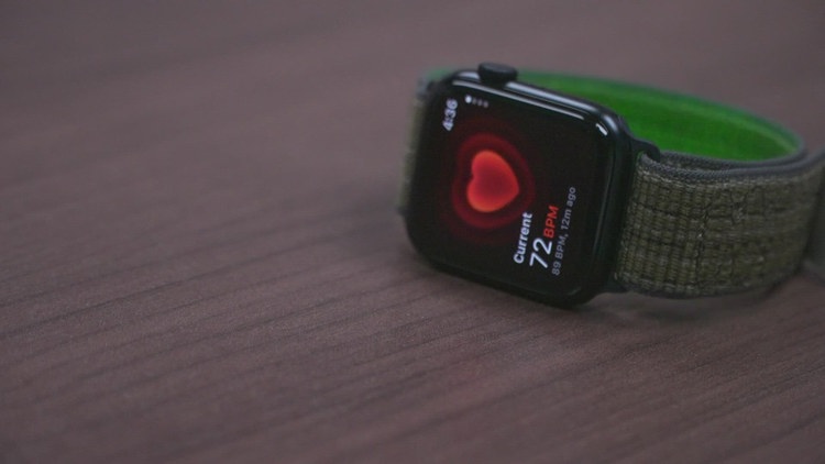 New study looks at how to expand benefits for patients with heart condition using Apple Watch