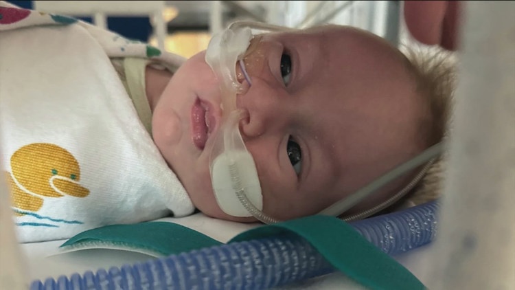 Newborn survives rare medical procedure that saved his life