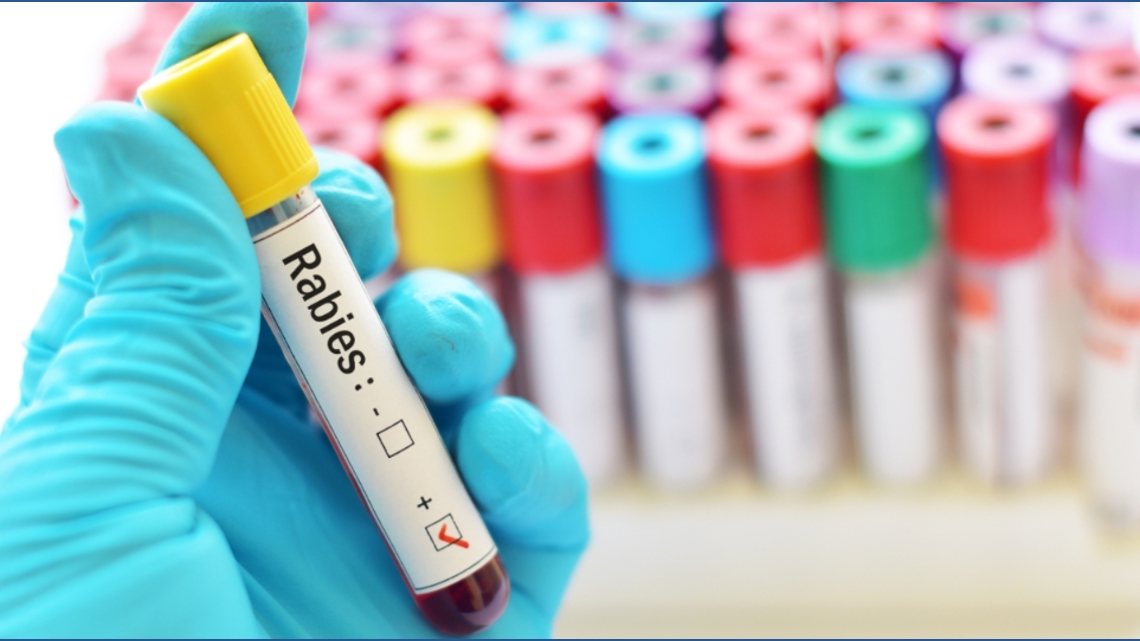 2 cases of rabies detected in Iowa, both with connections to skunks