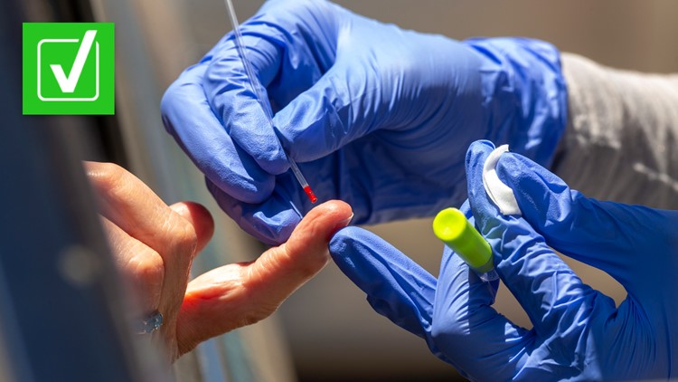 Yes, it is possible to tell the difference between COVID-19 antibodies and vaccine antibodies