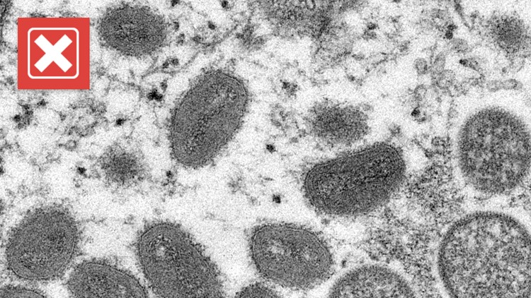 No, monkeypox is not considered a sexually transmitted disease