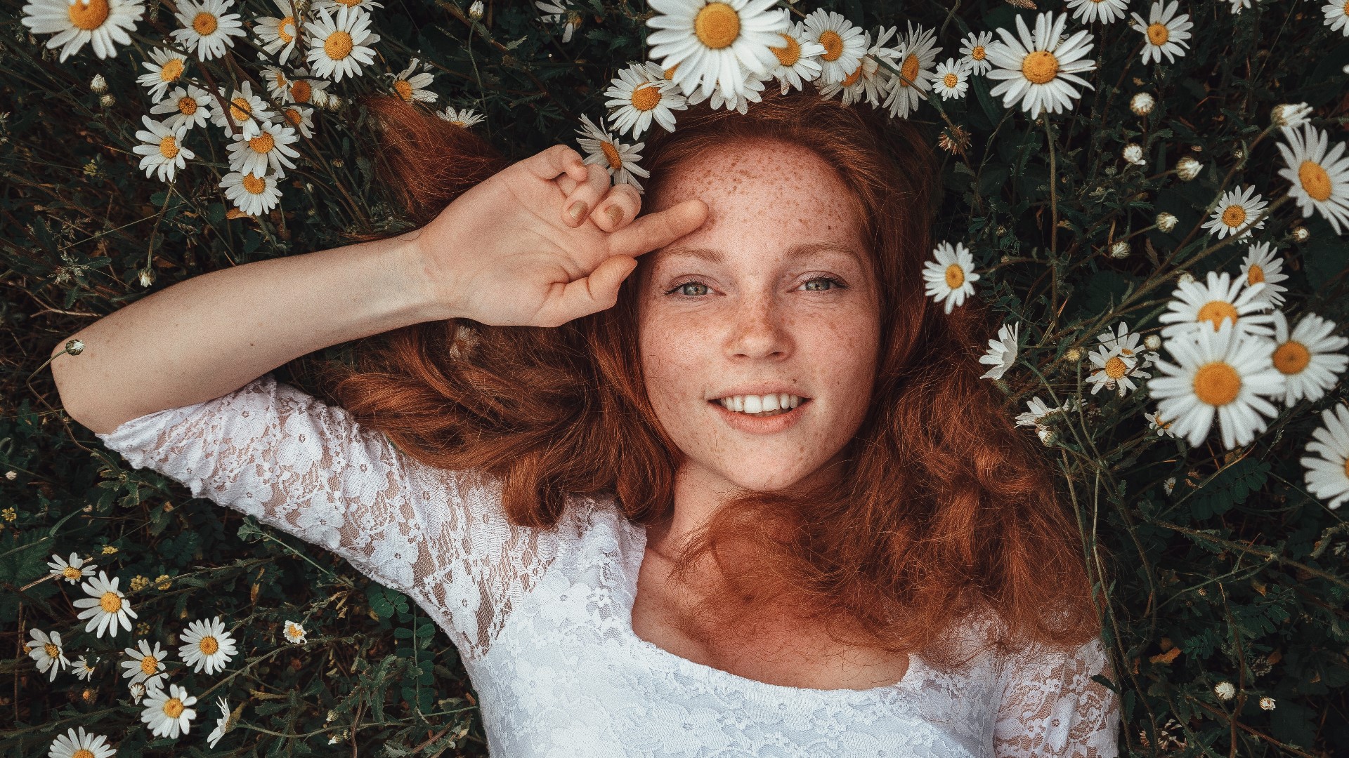 World Redhead Day 2023 3 Fast Facts About Redheads