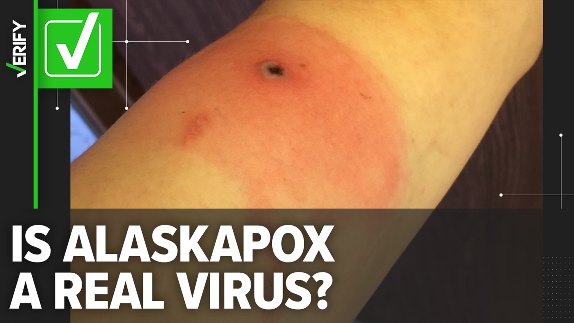 Alaskapox, which was identified in 2015, is a rare orthopoxvirus related to smallpox. An elderly man in Alaska is the first reported person to die of the virus.