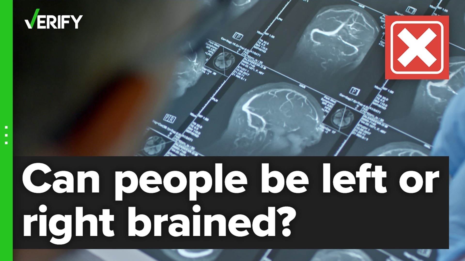 Left Brain vs Right Brain Tests by Treetop Teaching