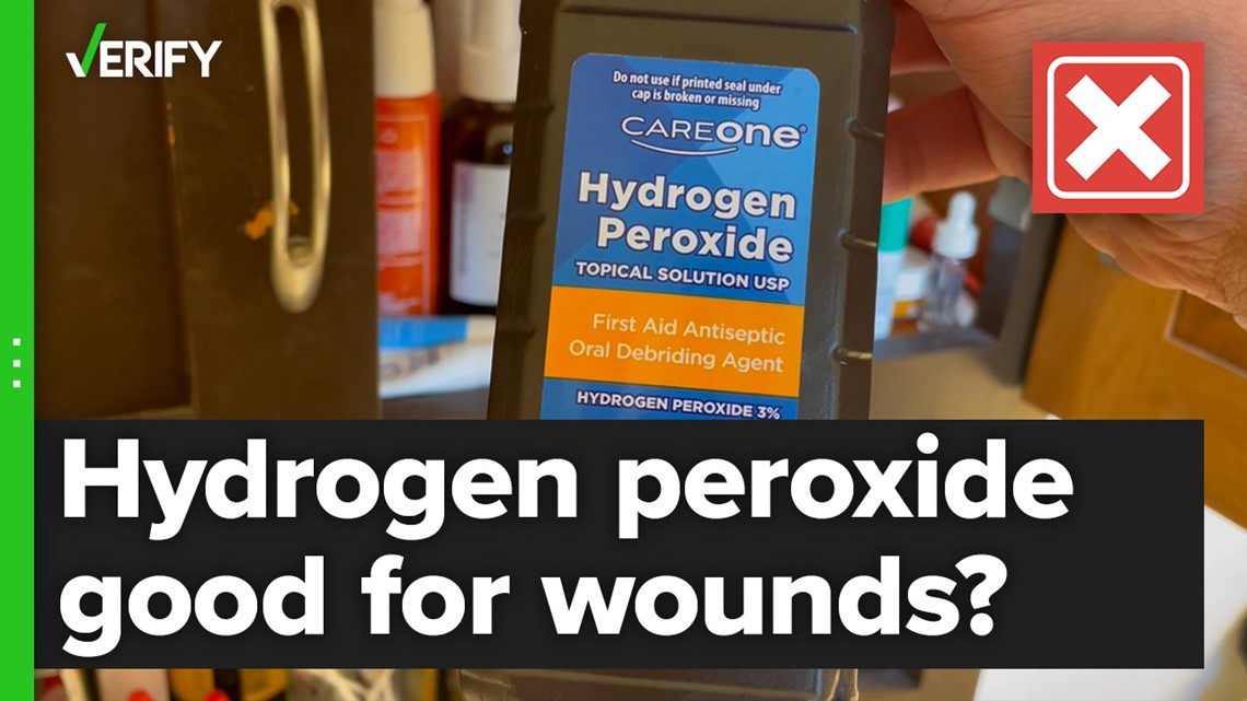 You should not use hydrogen peroxide on wounds