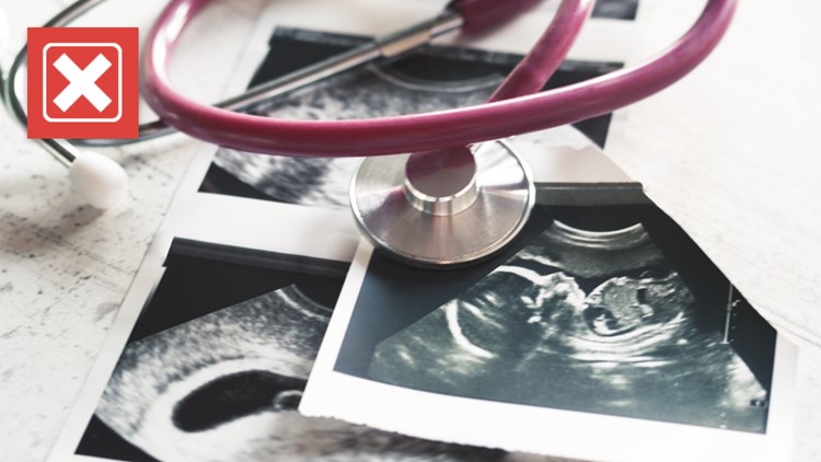 No, abortion rates are not &lsquo;out the roof&rsquo; as Kirstie Alley claimed