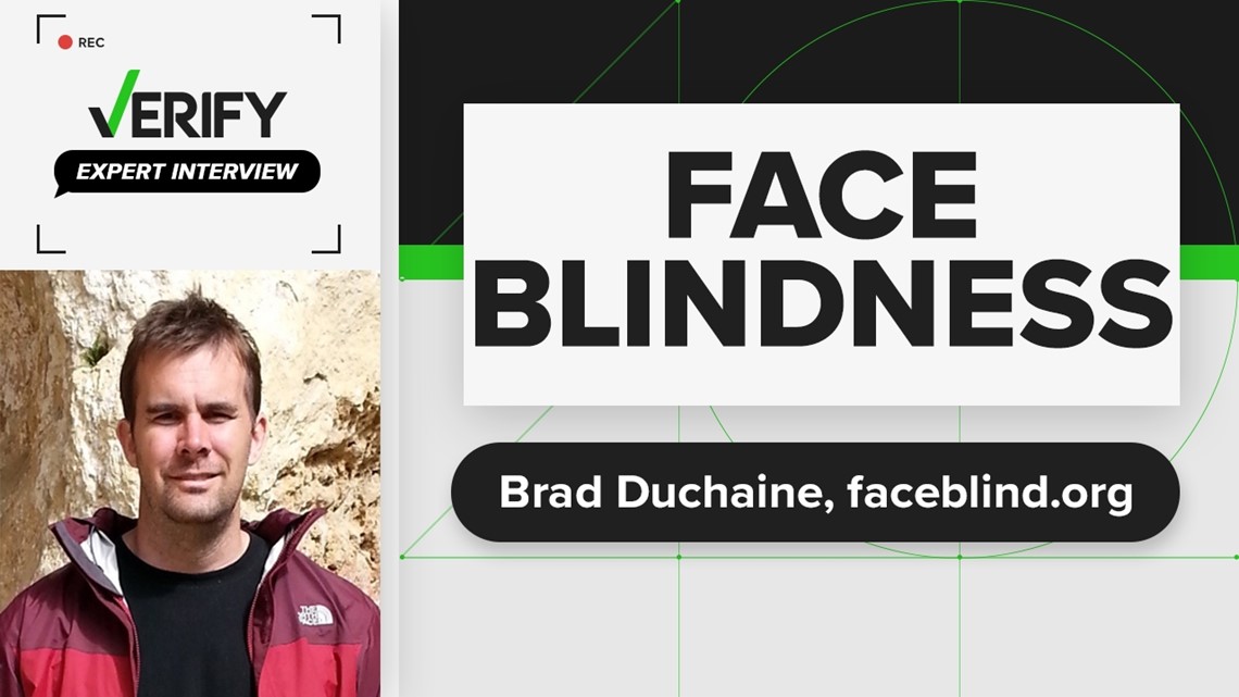 What is face blindness and is it a real condition?