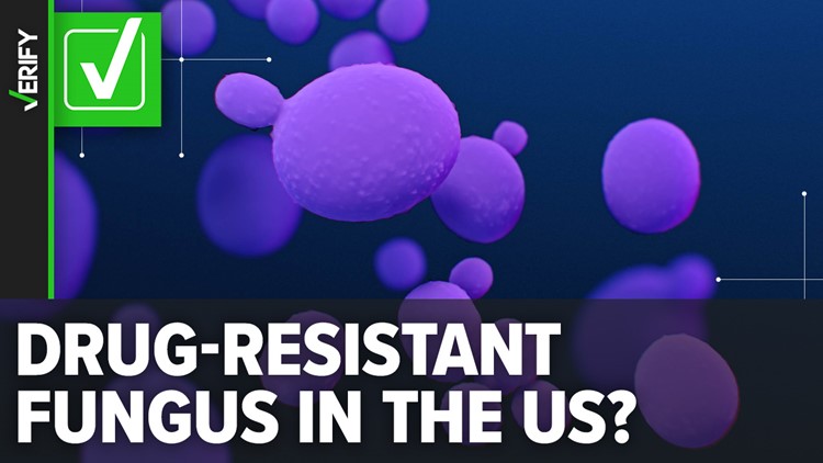 A drug-resistant fungus is spreading in U.S.