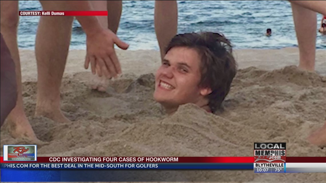 Teen infected with hookworms after walking on Florida beach - ABC7