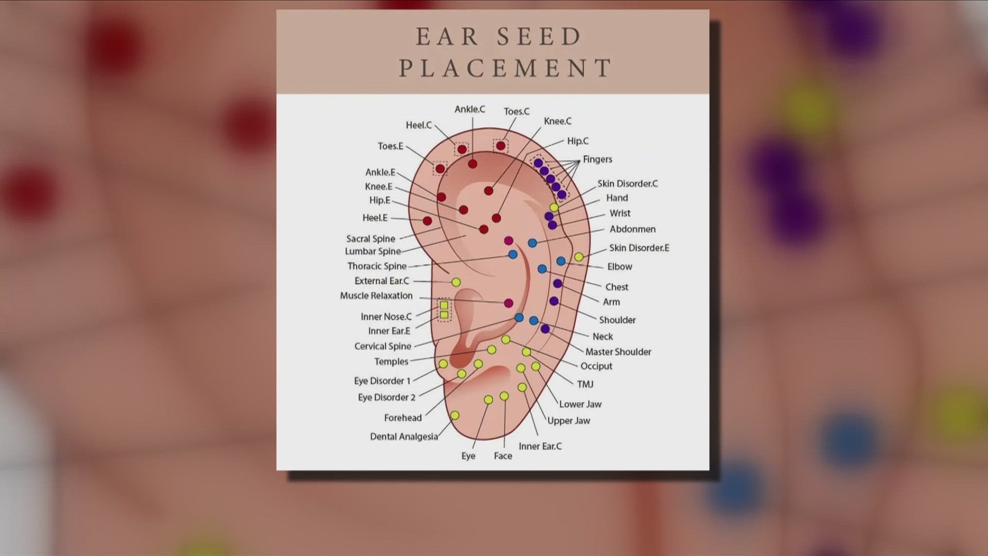 A Mid-South specialist shows how acupuncture can be used to treat allergies.