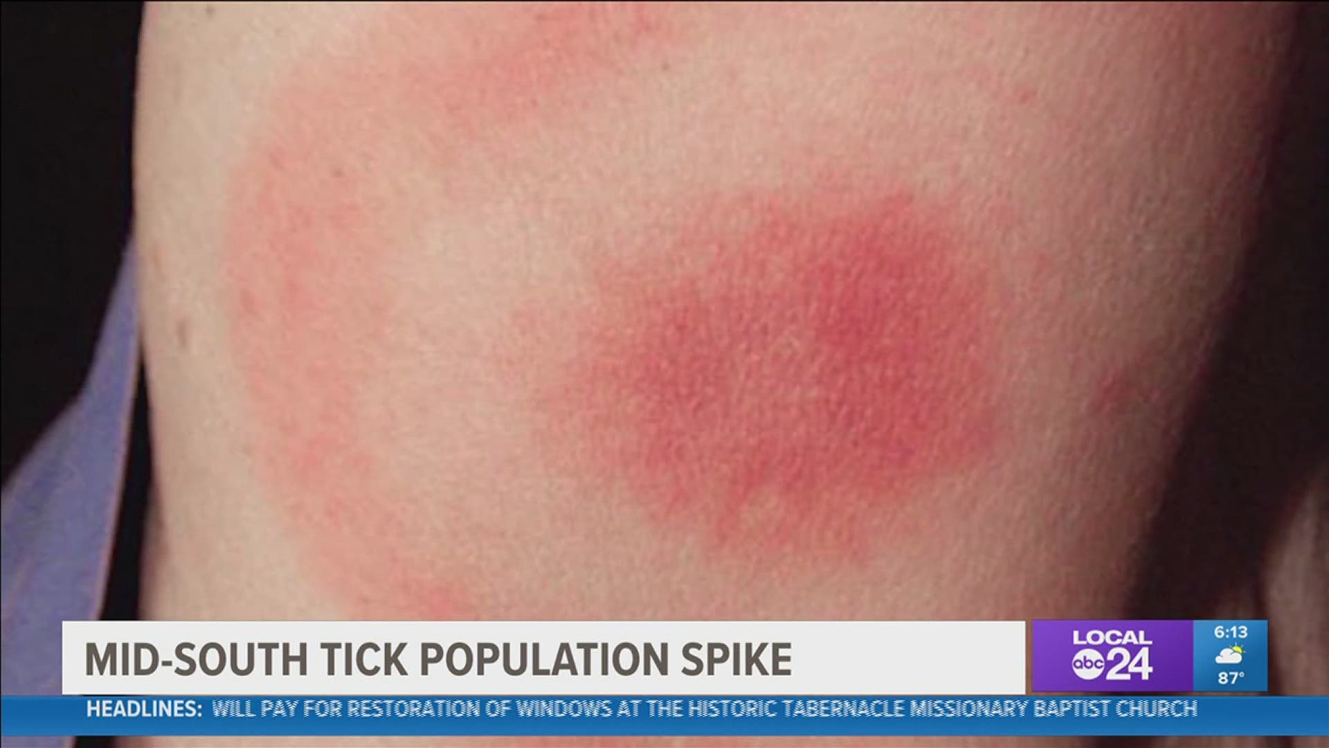 The local trend follows concern this week from national experts about a rise in the national tick population due to shorter winters and warmer temperatures.