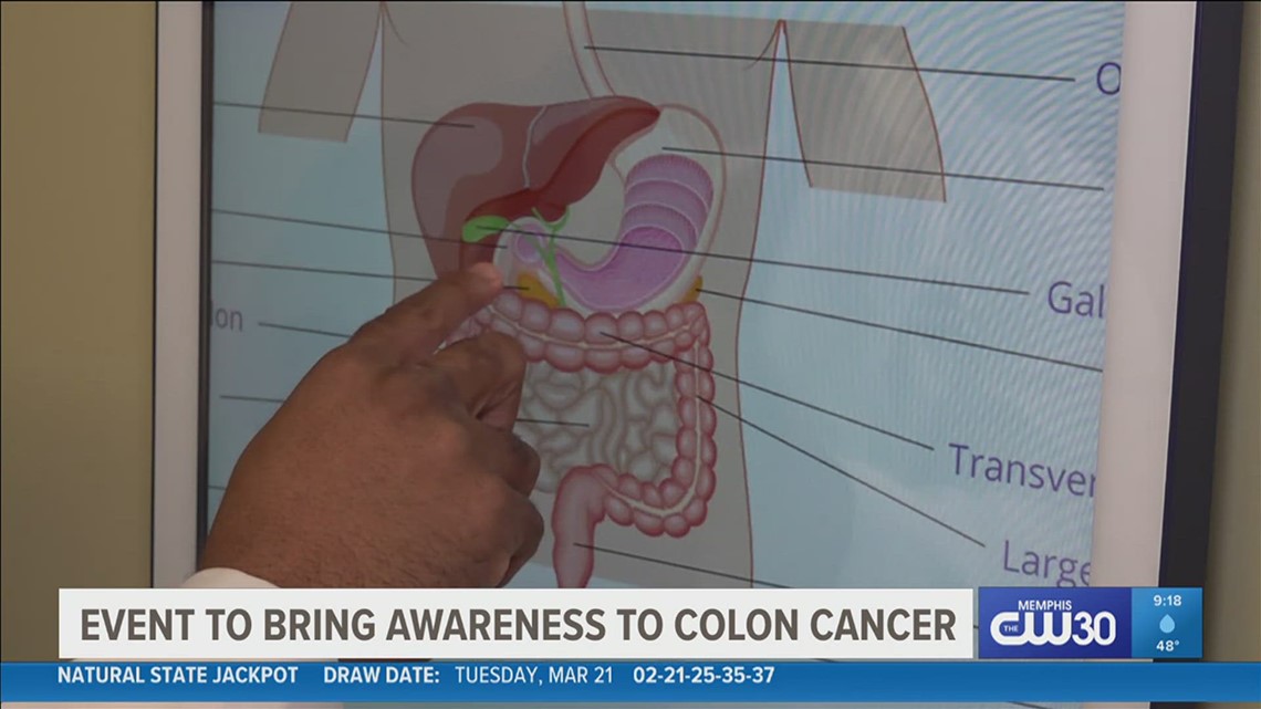 Event Thursday highlights importance of screening for colon cancer