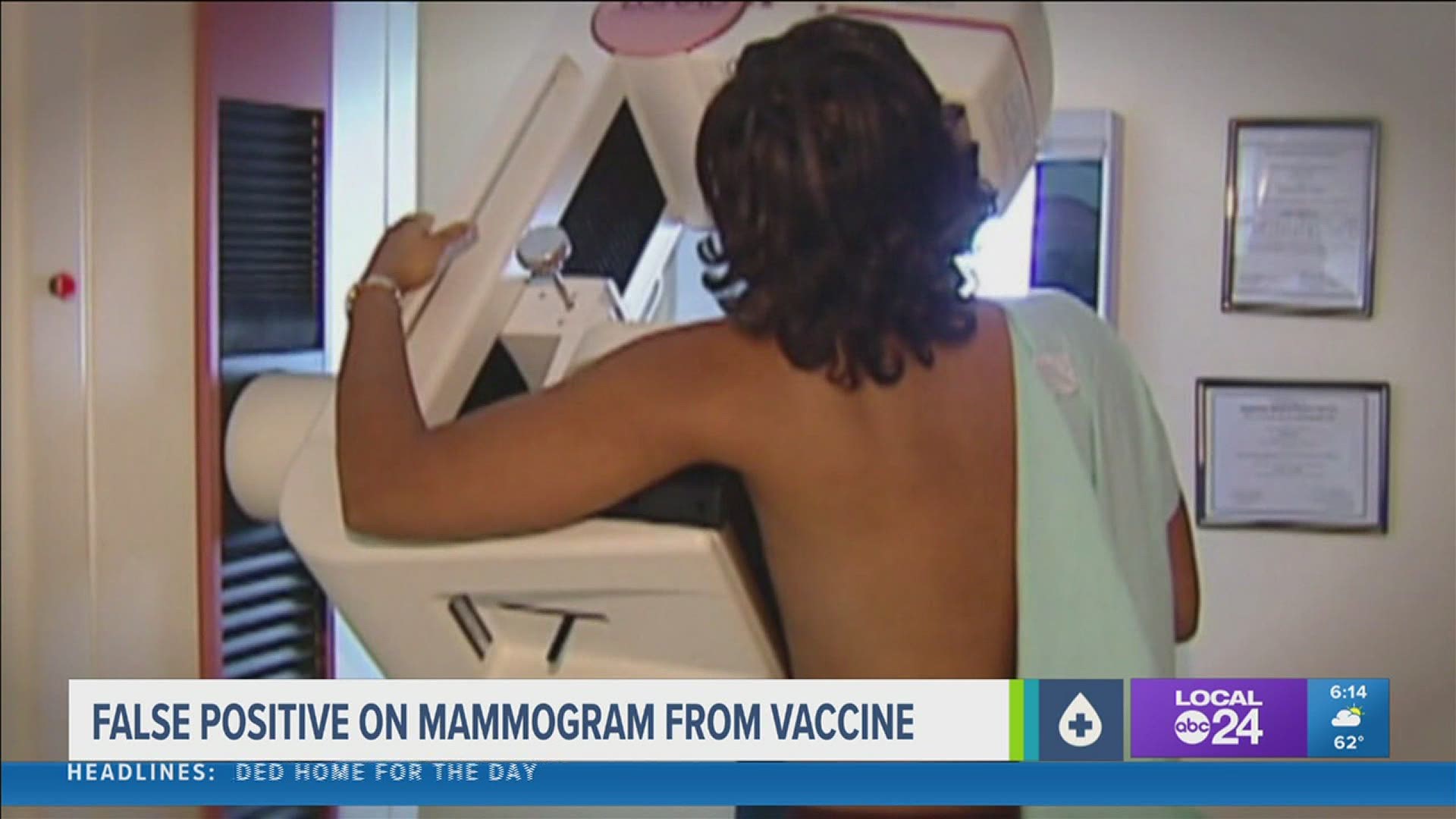 If you have a mammogram scheduled too close to when you received your second dose of the shot, you run the risk of receiving a “false positive.”