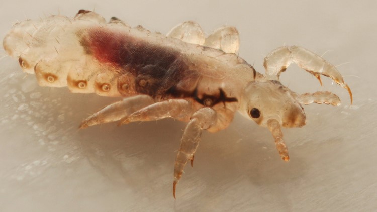 Got an itch to scratch? Head lice cases skyrocket across East Tennessee Got an itch to scratch? Head lice cases skyrocket across East Tennessee