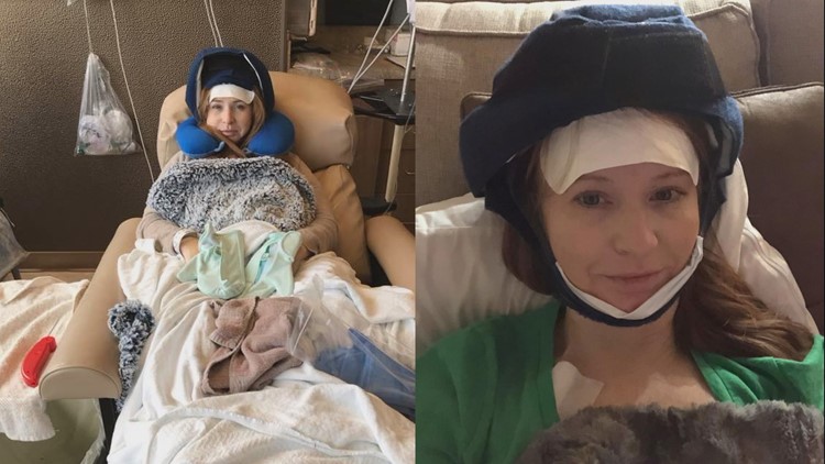 Buddy Check 10: Breast cancer survivor shares hair-saving secret