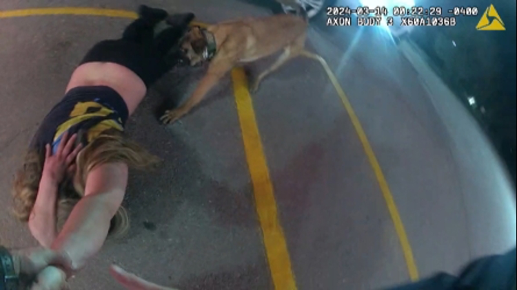 10Investigates: KCSO K-9 bite leaves woman with scars, hundreds of thousands in medical bills