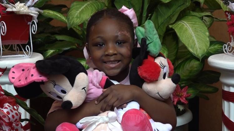 Church congregation rallies to surprise little girl with gifts after accident