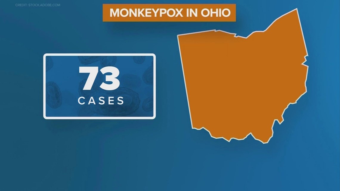 Ohio sees slight increase in monkeypox cases