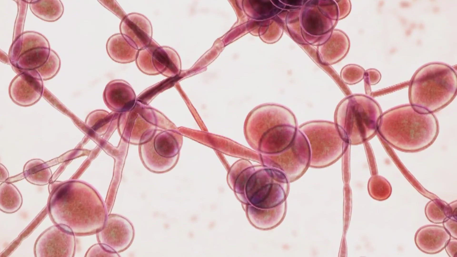 In a new report, the CDC says Candida auris spread at a concerning rate in healthcare facilities across the country from 2021–2022.